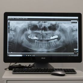 Clínica Dental Eva María Millan Prado monitor